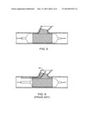 DELIVERY SYSTEM FOR BIFURCATION STENTS diagram and image