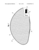 PROSTHETIC IMPLANT SHELL diagram and image