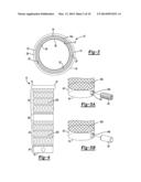 Implant Sleeve For Orthopedic Implants diagram and image