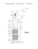 Implant Sleeve For Orthopedic Implants diagram and image