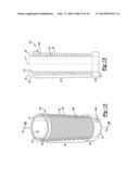 Implant Sleeve For Orthopedic Implants diagram and image