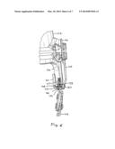 MANDIBLE GUARD ATTACHMENT SYSTEM diagram and image