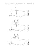 SURFACE COVERINGS HAVING A PLURALITY OF OVERLAPPING ELEMENTS AND METHODS     FOR FORMING SAME diagram and image