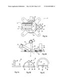 SYSTEM FOR POSITIONING ON A PATIENT AN OBSERVATION AND/OR INTERVENTION     DEVICE diagram and image