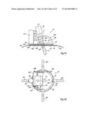 SYSTEM FOR POSITIONING ON A PATIENT AN OBSERVATION AND/OR INTERVENTION     DEVICE diagram and image