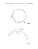 SYSTEM FOR POSITIONING ON A PATIENT AN OBSERVATION AND/OR INTERVENTION     DEVICE diagram and image