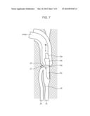 LARYNGEAL MASK diagram and image