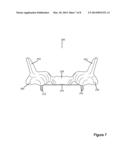 Dental Appliance for Treatment of Obstructive Sleep Apnea (OSA) and Sleep     Bruxism diagram and image