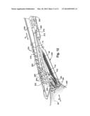 ENDOSCOPIC STAPLER diagram and image