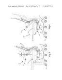 Chair Assembly with Upholstery Covering diagram and image