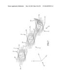 PREOPERATIVELY PLANNING AN ARTHROPLASTY PROCEDURE AND GENERATING A     CORRESPONDING PATIENT SPECIFIC ARTHROPLASTY RESECTION GUIDE diagram and image