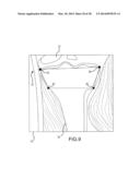 PREOPERATIVELY PLANNING AN ARTHROPLASTY PROCEDURE AND GENERATING A     CORRESPONDING PATIENT SPECIFIC ARTHROPLASTY RESECTION GUIDE diagram and image