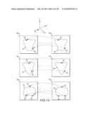 PREOPERATIVELY PLANNING AN ARTHROPLASTY PROCEDURE AND GENERATING A     CORRESPONDING PATIENT SPECIFIC ARTHROPLASTY RESECTION GUIDE diagram and image