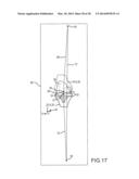 PREOPERATIVELY PLANNING AN ARTHROPLASTY PROCEDURE AND GENERATING A     CORRESPONDING PATIENT SPECIFIC ARTHROPLASTY RESECTION GUIDE diagram and image