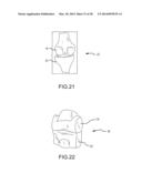 PREOPERATIVELY PLANNING AN ARTHROPLASTY PROCEDURE AND GENERATING A     CORRESPONDING PATIENT SPECIFIC ARTHROPLASTY RESECTION GUIDE diagram and image