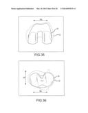 PREOPERATIVELY PLANNING AN ARTHROPLASTY PROCEDURE AND GENERATING A     CORRESPONDING PATIENT SPECIFIC ARTHROPLASTY RESECTION GUIDE diagram and image