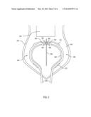 ILLUMINATED VEST diagram and image