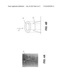 RIB SUPPRESSION IN RADIOGRAPHIC IMAGES diagram and image