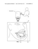 TEMPORARY DENTAL PROSTHESIS FOR USE IN DEVELOPING FINAL DENTAL PROSTHESIS diagram and image