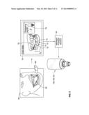 TEMPORARY DENTAL PROSTHESIS FOR USE IN DEVELOPING FINAL DENTAL PROSTHESIS diagram and image