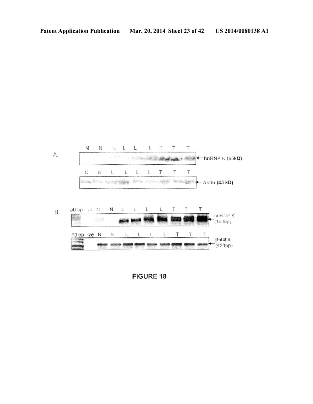 Biomarkers for Head-and-Neck Cancers and Precancers - diagram, schematic, and image 24