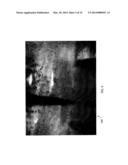 ULTRASOUND AND ACOUSTOPHORESIS FOR COLLECTION AND PROCESSING OF OLEAGINOUS     MICROORGANISMS diagram and image