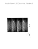 ULTRASOUND AND ACOUSTOPHORESIS FOR COLLECTION AND PROCESSING OF OLEAGINOUS     MICROORGANISMS diagram and image