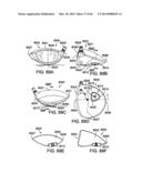 GOLF CLUB HEAD diagram and image