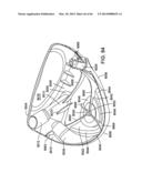 GOLF CLUB HEAD diagram and image