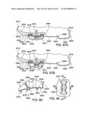 GOLF CLUB HEAD diagram and image