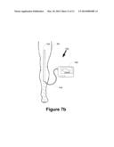 NON-INVASIVE SENSOR APPARATUS AND METHOD FOR ASSESSING CARDIAC PERFORMANCE diagram and image