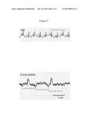 ELECTROPHYSIOLOGICAL DIAGNOSIS AND TREATMENT FOR ASTHMA diagram and image