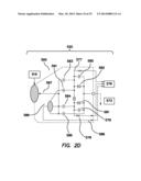 METHOD AND APPARATUS FOR MEASURING BIOPOTENTIAL AND MAPPING EPHAPTIC     COUPLING EMPLOYING A CATHETER WITH MOSFET SENSOR ARRAY diagram and image