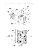 METHOD AND APPARATUS FOR MEASURING BIOPOTENTIAL AND MAPPING EPHAPTIC     COUPLING EMPLOYING A CATHETER WITH MOSFET SENSOR ARRAY diagram and image