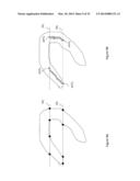 MYOCARDIAL CLUSTERIFICATION AND ORIENTATION diagram and image