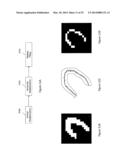 MYOCARDIAL CLUSTERIFICATION AND ORIENTATION diagram and image