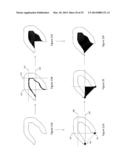 MYOCARDIAL CLUSTERIFICATION AND ORIENTATION diagram and image