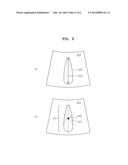 METHOD AND APPARATUS FOR GUIDING SCAN LINE BY USING COLOR DOPPLER IMAGE diagram and image