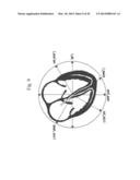 ANALYSIS OF ELECTROCARDIOGRAM SIGNALS diagram and image