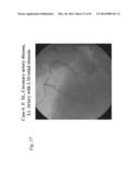 ANALYSIS OF ELECTROCARDIOGRAM SIGNALS diagram and image