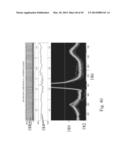 ANALYSIS OF ELECTROCARDIOGRAM SIGNALS diagram and image