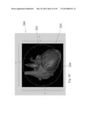 ANALYSIS OF ELECTROCARDIOGRAM SIGNALS diagram and image