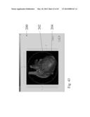 ANALYSIS OF ELECTROCARDIOGRAM SIGNALS diagram and image