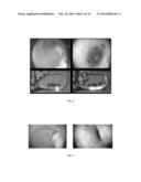 SYSTEM AND METHOD OF TETHERLESS INSUFFLATION IN COLON CAPSULE ENDOSCOPY diagram and image