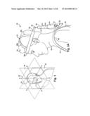 Subject-Mounted Device to Measure Relative Motion of Human Joints diagram and image