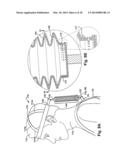 Subject-Mounted Device to Measure Relative Motion of Human Joints diagram and image