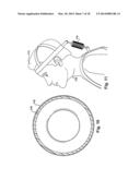 Subject-Mounted Device to Measure Relative Motion of Human Joints diagram and image