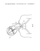 Subject-Mounted Device to Measure Relative Motion of Human Joints diagram and image