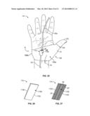 INTRAVENOUS LINE STABILIZATION DEVICE AND METHOD diagram and image