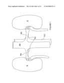 METHODS AND APPARATUS FOR RENAL NEUROMODULATION diagram and image